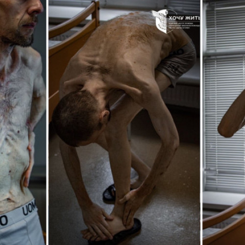 Foto Imagini șocante cu un prizonier ucrainean după doi ani de captivitate în Rusia. „Evocă cele mai întunecate pagini ale istoriei umane”