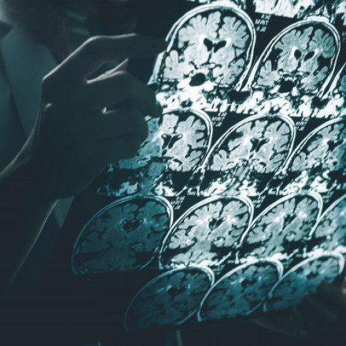 Boala misterioasă lovește Canada: fără explicații, oficialii sunt suspectați de un secret