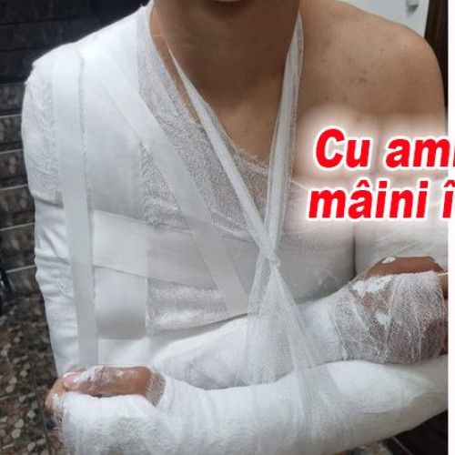 Băiat de 15 ani, cu mâinile în gips după un accident cu bicicleta