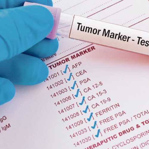 Guvernul a Adoptat o Hotărâre pentru Accesul Persoanelor Neasigurate la Servicii Oncologice