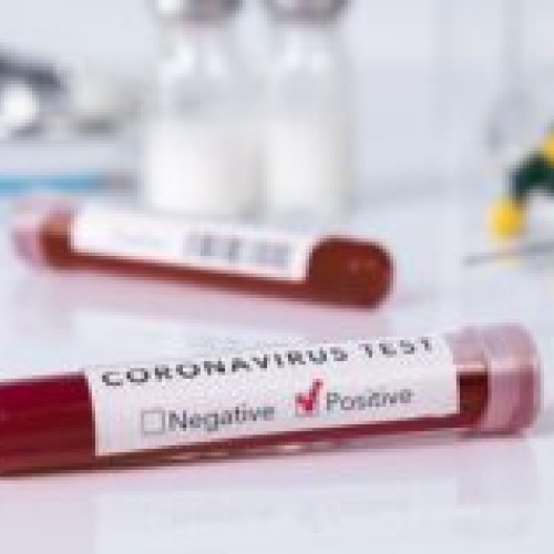 Ministerul Sănătății anunță 310 cazuri noi de COVID-19 în săptămâna 17 - 23 iunie