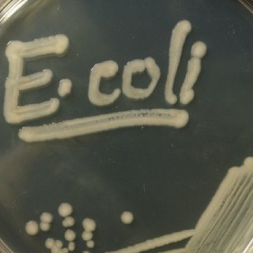 Un caz de deces în Marea Britanie asociat cu epidemia de E. coli