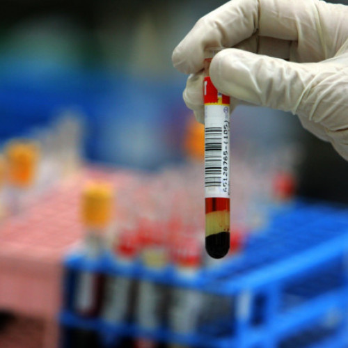 Profesor de medicină american acuzat de fraudă pentru trimiterea de date false în cercetări Alzheimer