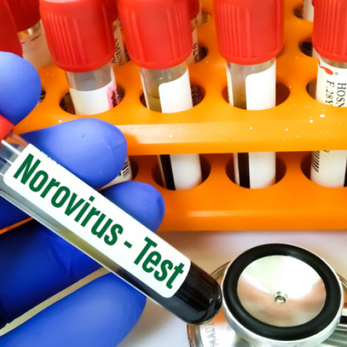 Focar de norovirus în Torri del Benaco, Italia: peste 300 de persoane spitalizate