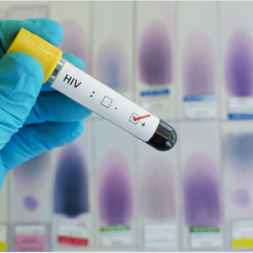 Gravidele neasigurate vor avea acces gratuit la testarea HIV-SIDA de la 1 iulie