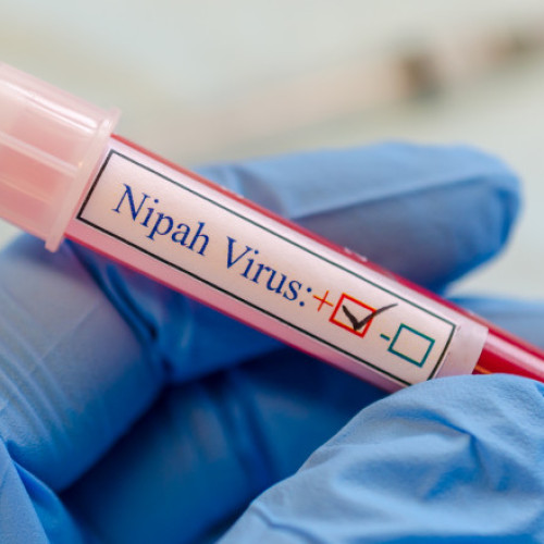 Virusul Nipah generează măsuri de prevenție în Asia, riscul pentru România rămâne redus