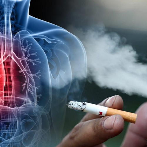 Cercetare OMS: Multe cazuri de cancer pot fi prevenite prin schimbări de comportament