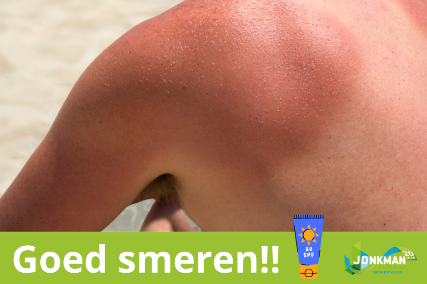 Safety Tips verbranding door zon