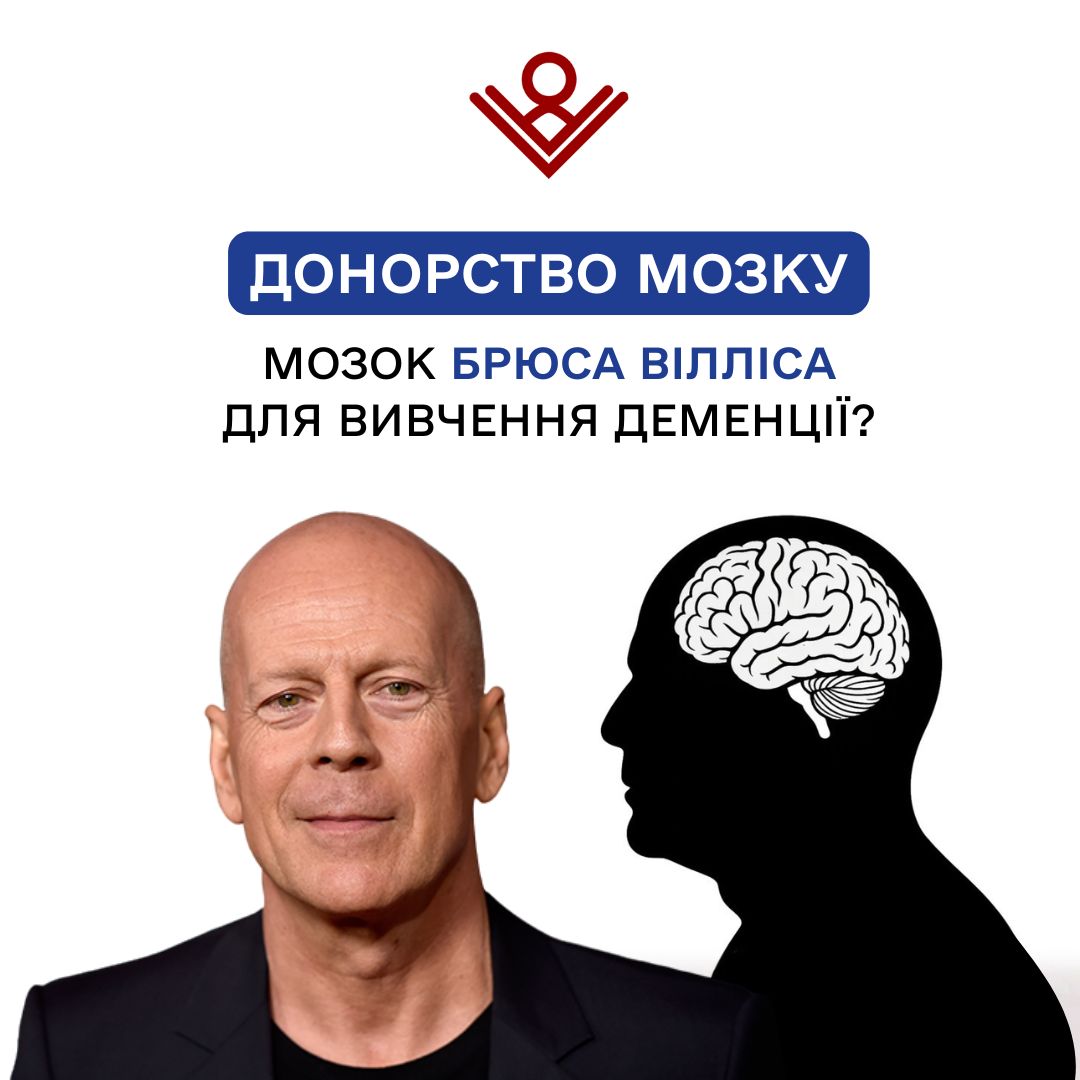 Донорство мозку