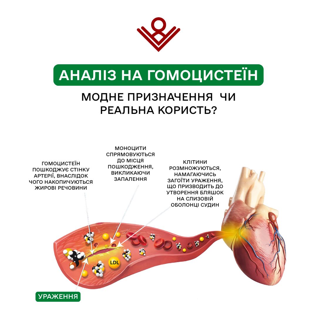 Гомоцистеїн