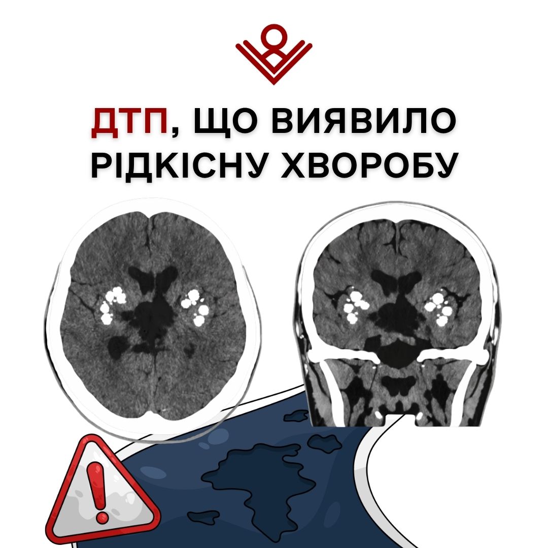 Сімейна хвороба Фара