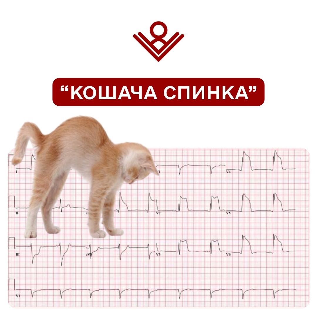 “Кошача спинка”