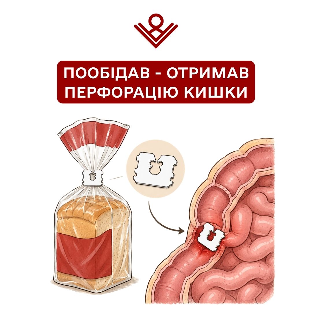 пообідав - отримав перфорацію кишки