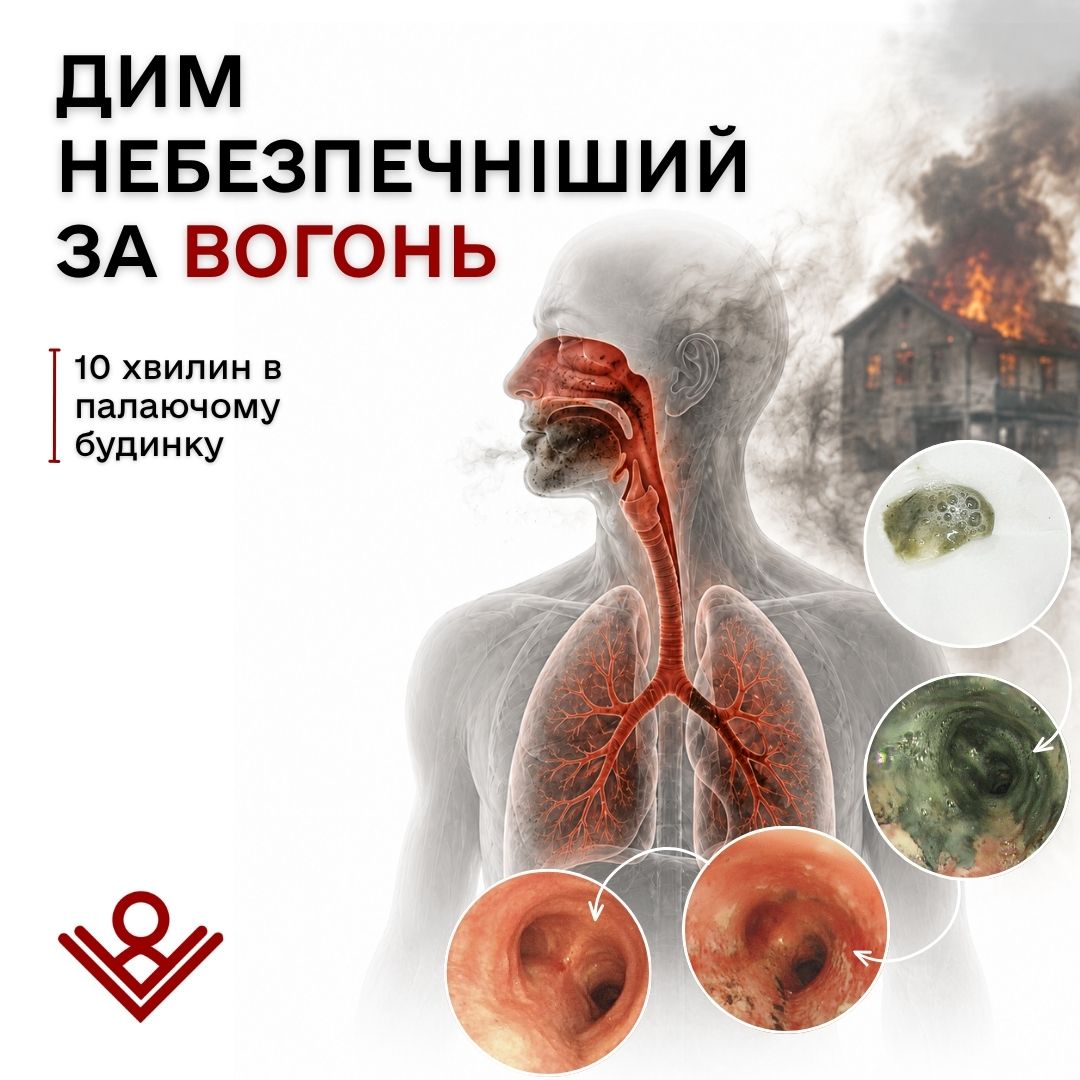 Дим небезпечніший за вогонь