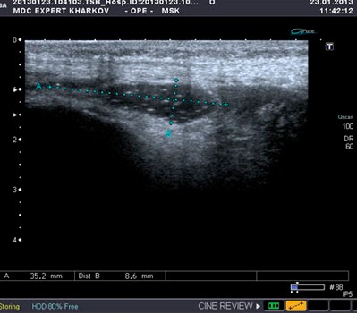 МРТ и УЗИ суставов
