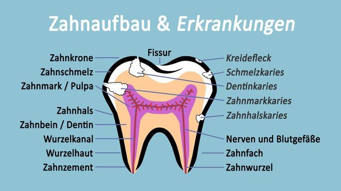 fuellung-bricht-nach-wurzelbehandlung-heraus-was-tun