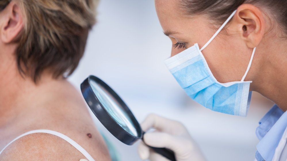 Médico com uma lupa analisando uma pinta em uma pacientes