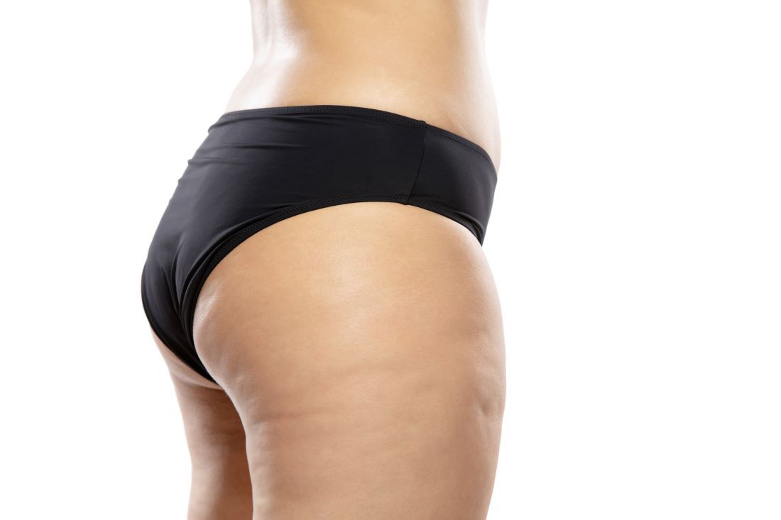 cuerpo mujer bragas negras celulitis piernas