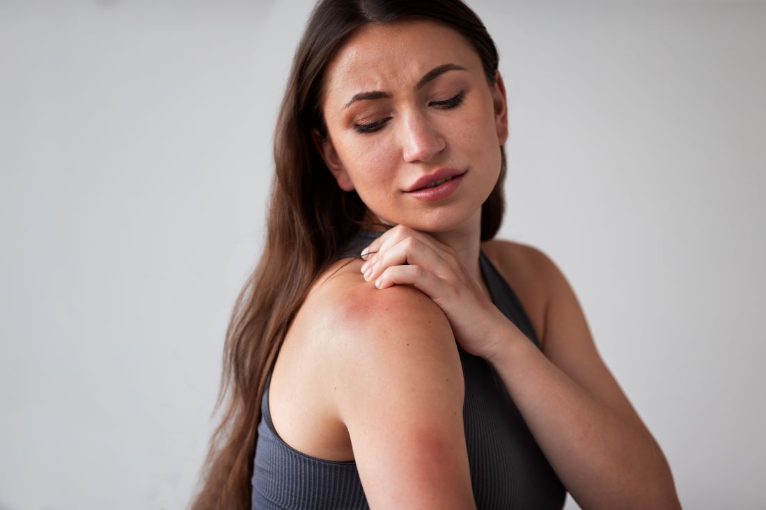 mujer picor eccema brazo camiseta tirantes