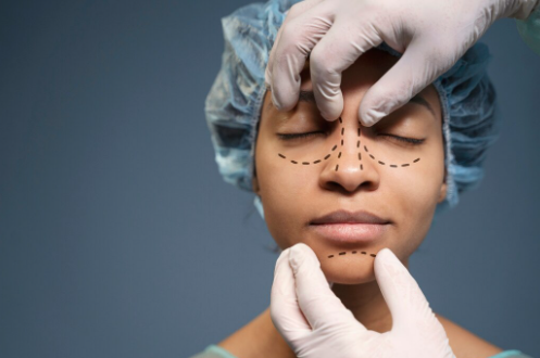 Doğallığın ve Nefesin Dengesi: Modern Rinoplastide Estetikten Öte Bir Denge