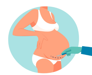 epidural-dogum-avantajlari-riskleri-ve-sureci-op-dr-zeynel-abidin-ozdil