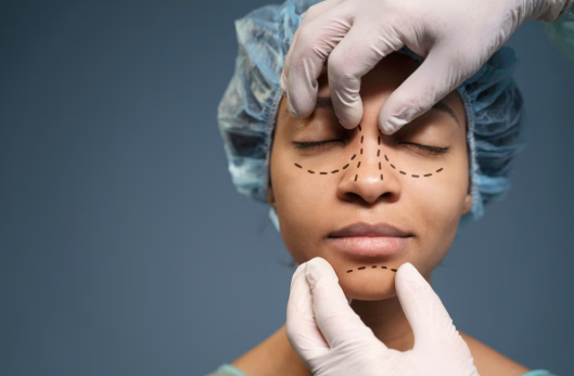 Rinoplasti nedir? - Op. Dr. Onur Ergün