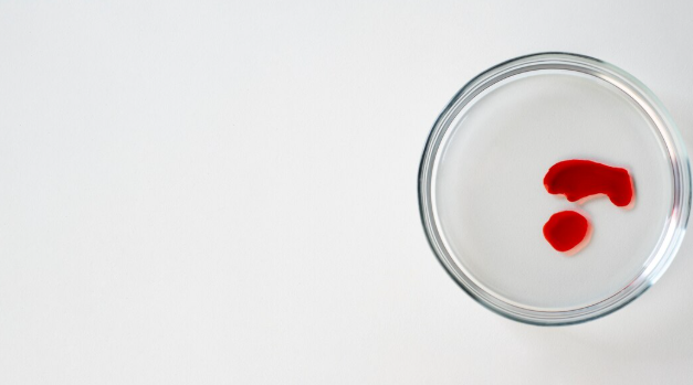 Meniden Kan Gelmesi (Hemospermi) Nedir? - Op. Dr. Taner Çavumirza