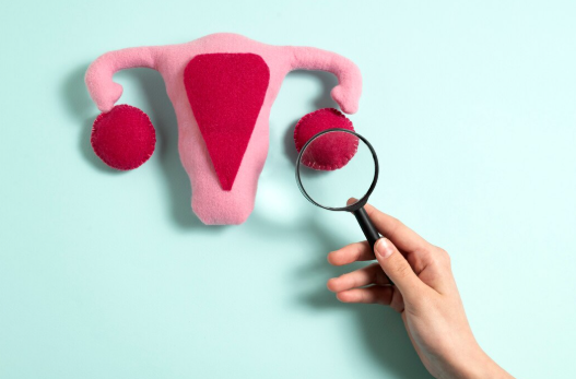 yumurtalik-kanserleri-op-dr-sare-dogan