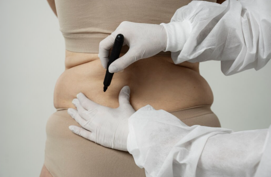 obezite-cerrahisinde-guvenligi-artiran-onemli-bir-adim-ameliyat-sirasinda-endoskopi-op-dr-vahit-mutlu