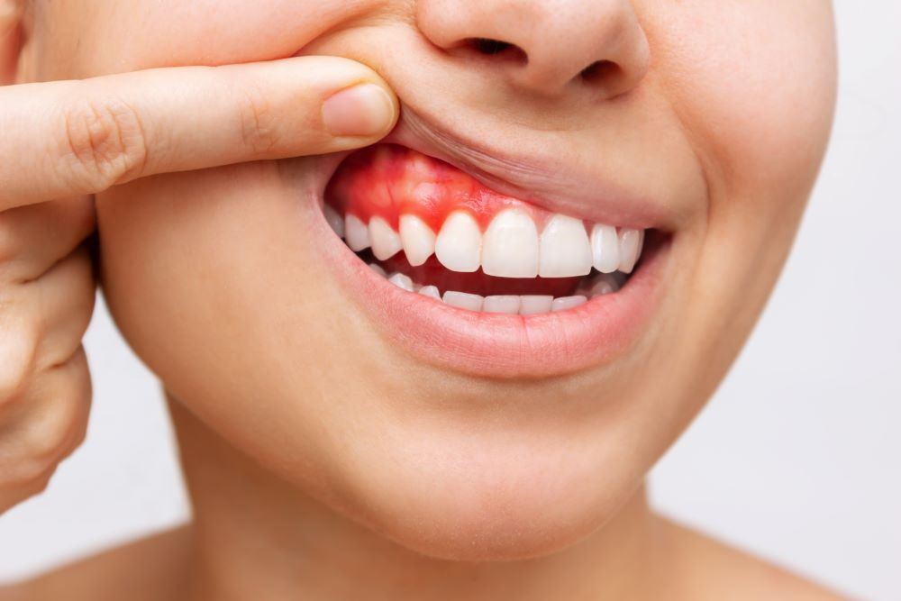 joven muestra encias dientes fondo blanco 