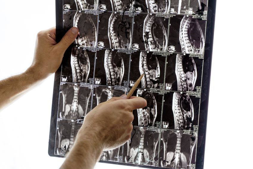radiografía de resonancia columna manos señalando