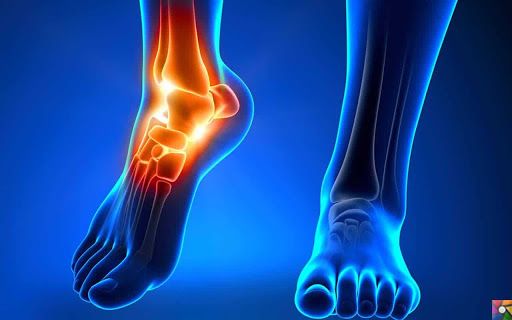 Ayakbilek Çevresi Kıkırdak Sorunları