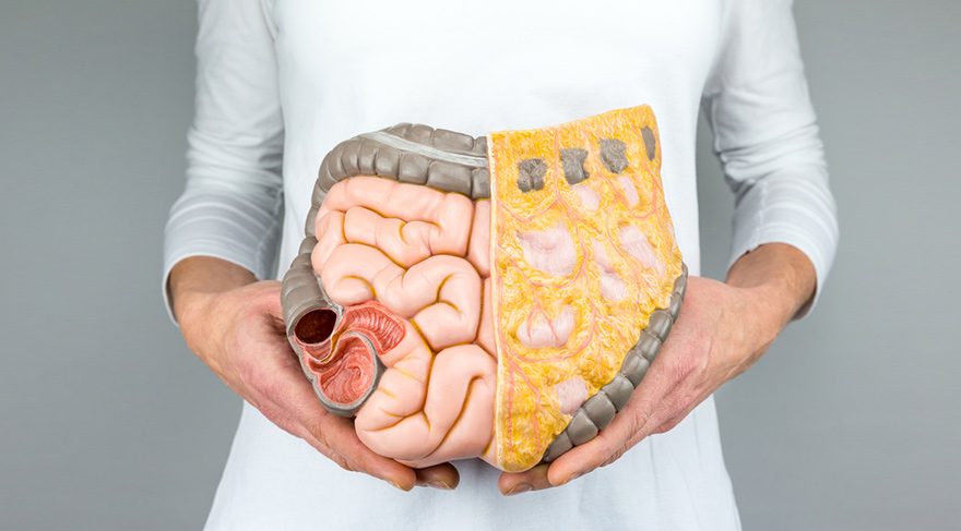 Bağırsak Kanserinde Erken Tanı