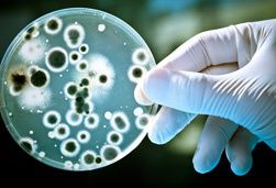 zahn-zahnbelag-plaque-karies-biofilm