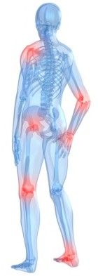 rheuma-hat-viele-gesichter