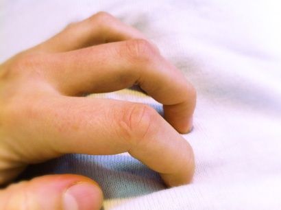 hauterkrankung-kraetze