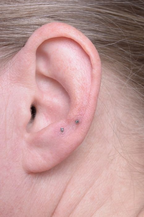 abnehmen-mit-akupunktur