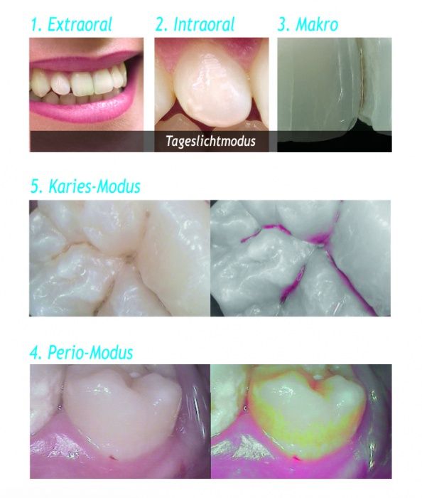 zahnarztphobie-besiegen