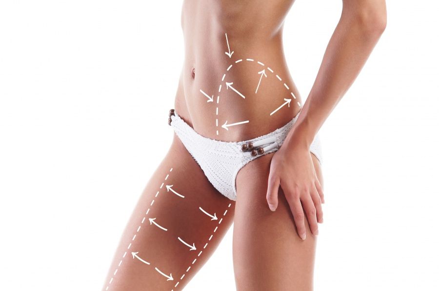 bodylift-vorteile-ablauf-risiken-nachbehandlung