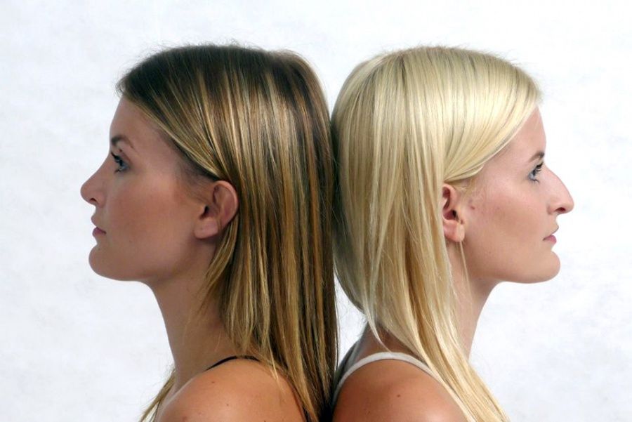 die-operative-nasenkorrektur