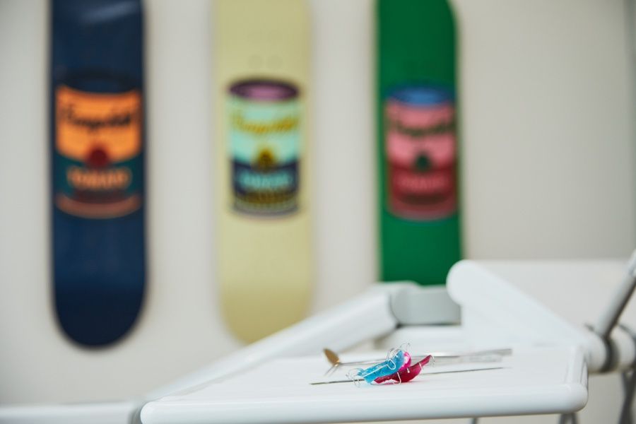 warum-bei-starken-zahnfehlstellungen-kig-3-eine-zahnspange-notwendig-ist