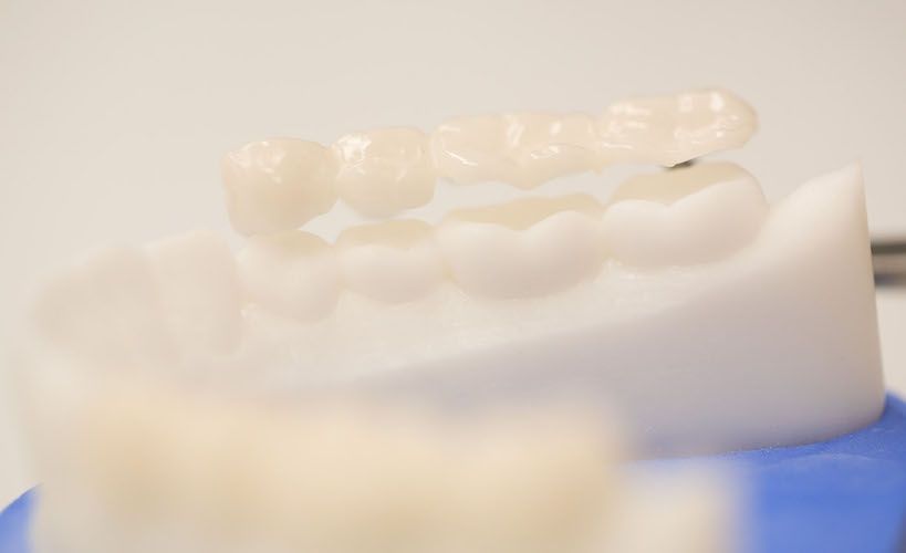 bisshebung-so-werden-sie-verspannungsschmerzen-los