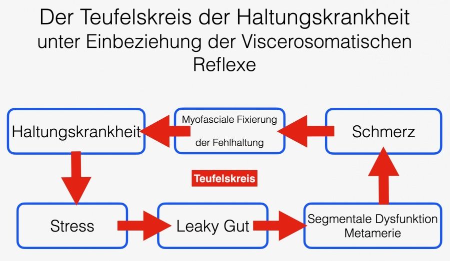 ein-haeufiger-grund-fuer-chronische-schmerzen-die-haltungskrankheit