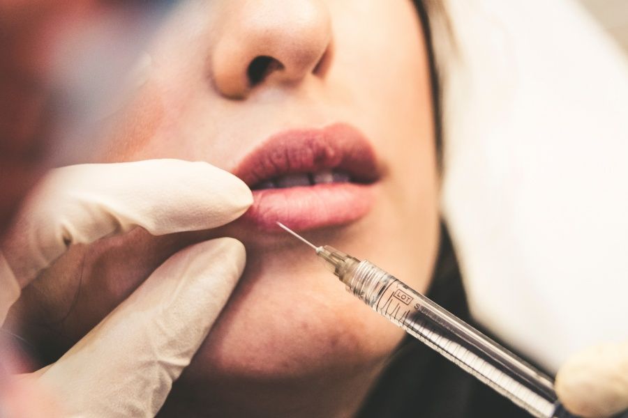 Botox und Hyaluronsäure, ein schlagkräftiges Duo