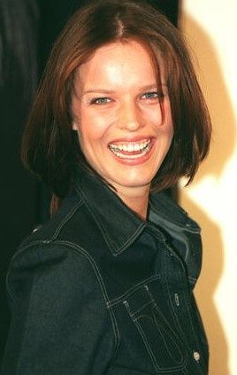 gummy-smile-korrektur-zahnfleischueberschuss-operation