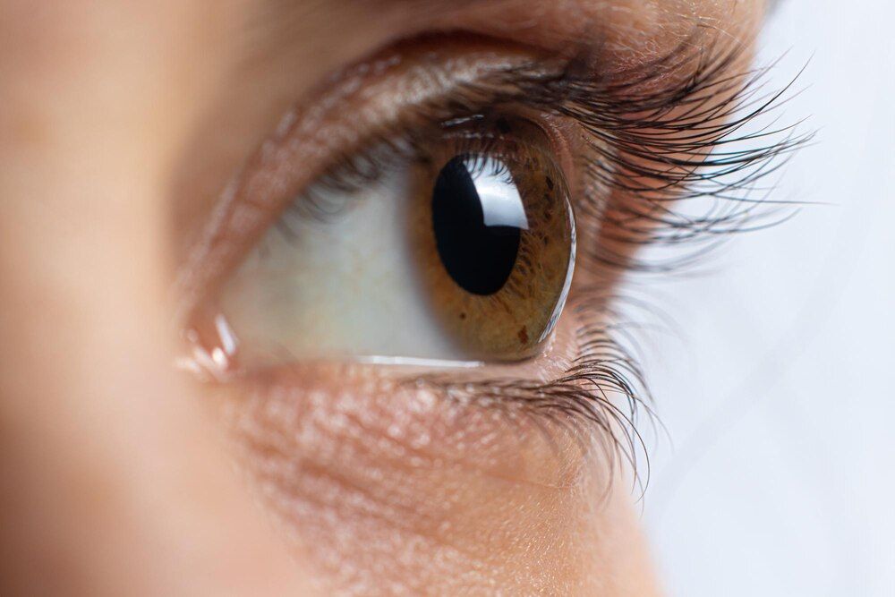 ceratocone ocular 4º grau contorção da córnea em forma de cone deterioração da visão astigmatismo macro close up