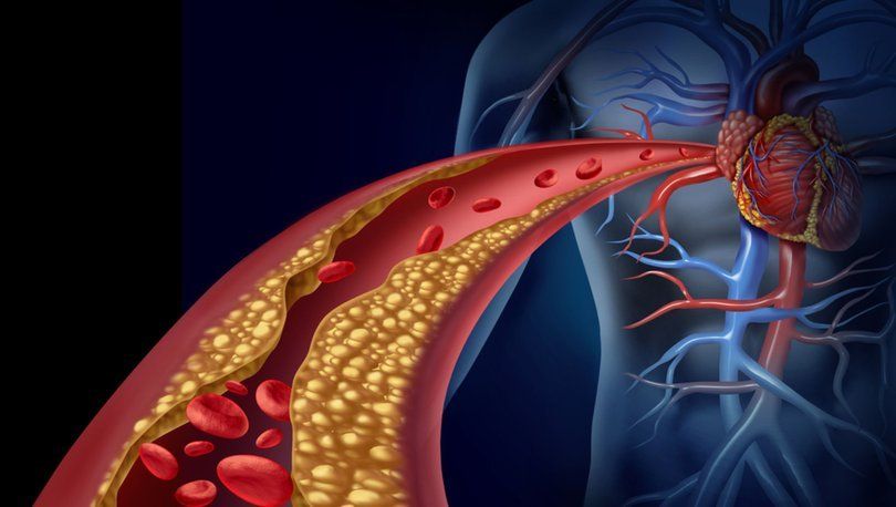 Damar Tıkanıklığı 2