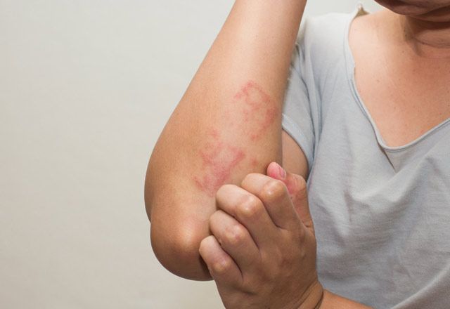 Deri Hastalıkları Karaciğerden Mi Akciğerden Mi?