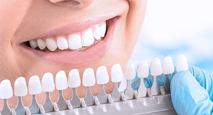 Diş Beyazlatma İşlemi 2