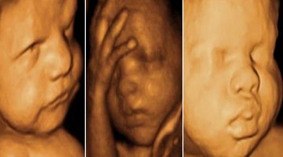 DÖRT BOYUTLU ULTRASONDA GÖRÜNTÜLEME